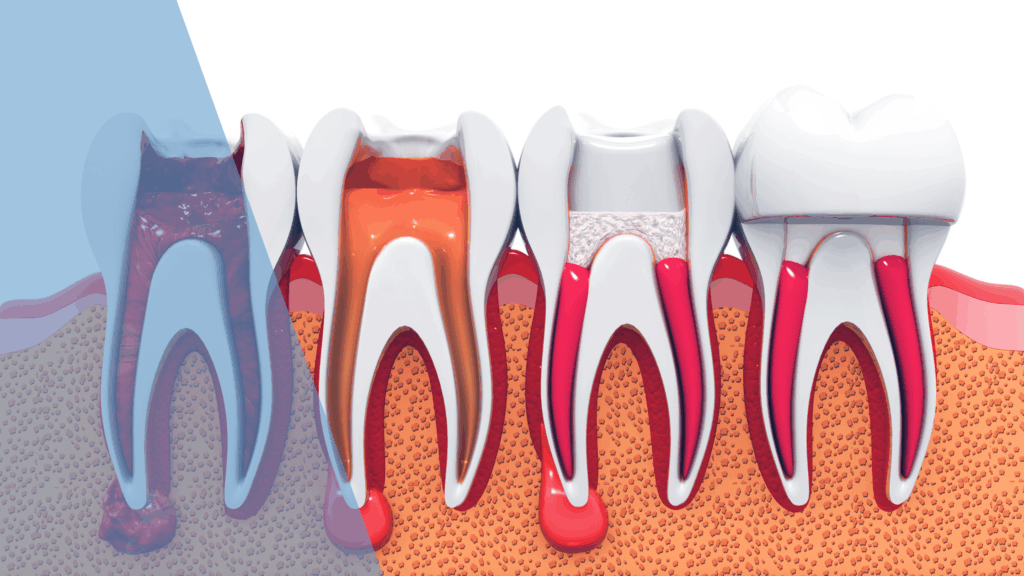 family dentist downtown Toronto Dental Arts Toronto performing scaling and root planing procedure