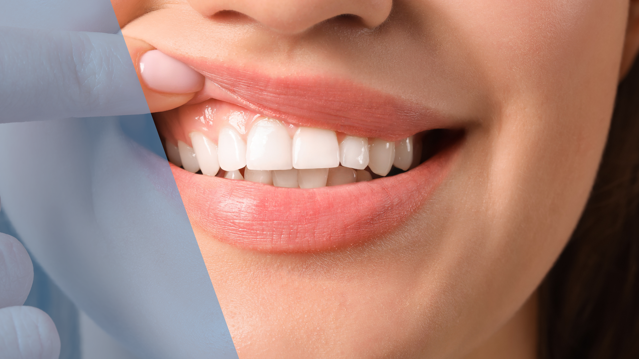 dentist in uptown Toronto gum disease treatment at Dental Arts At Front