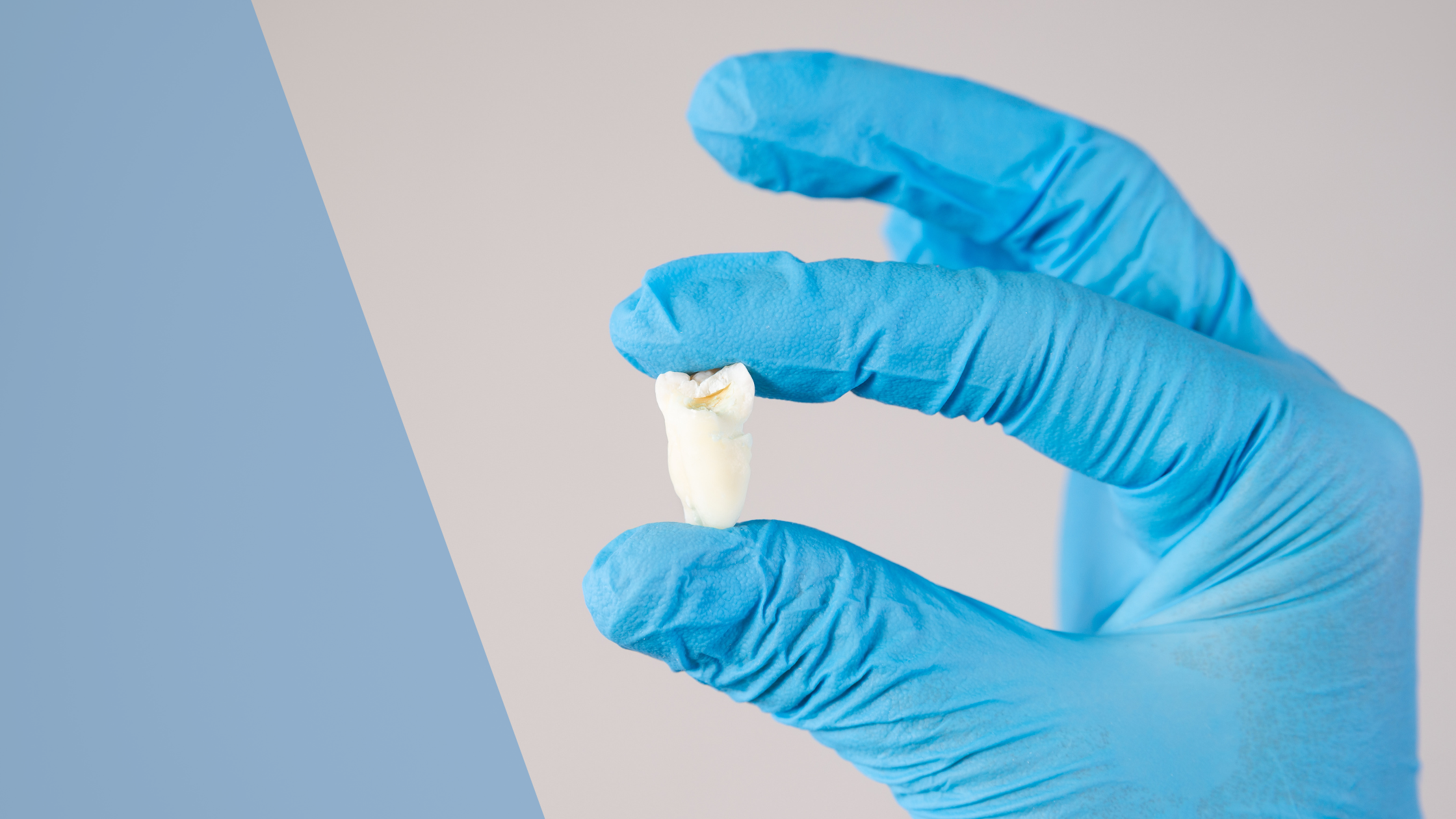 Wisdom teeth extractions myths and facts at Dental Arts Toronto uptown Toronto