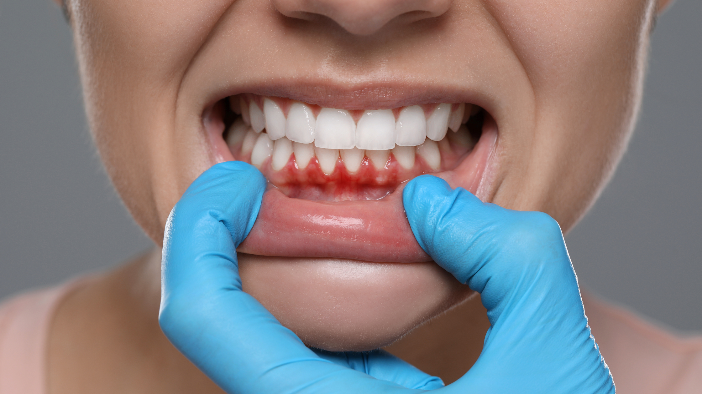 Dentistry in downtown Toronto gum disease treatment periodontal health, Dental Arts Front Street Toronto