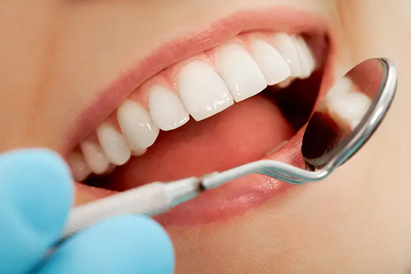 Gum reshaping in Toronto smile results at Dental Arts Toronto